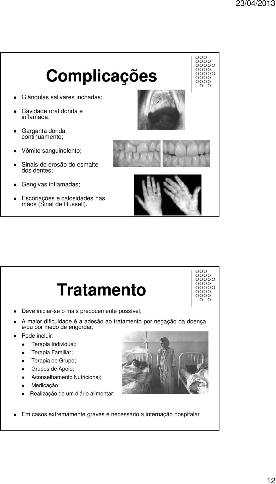 Tratamento Deve iniciar-se o mais precocemente possível; A maior dificuldade é a adesão ao tratamento por negação da doença e/ou por medo de engordar; Pode