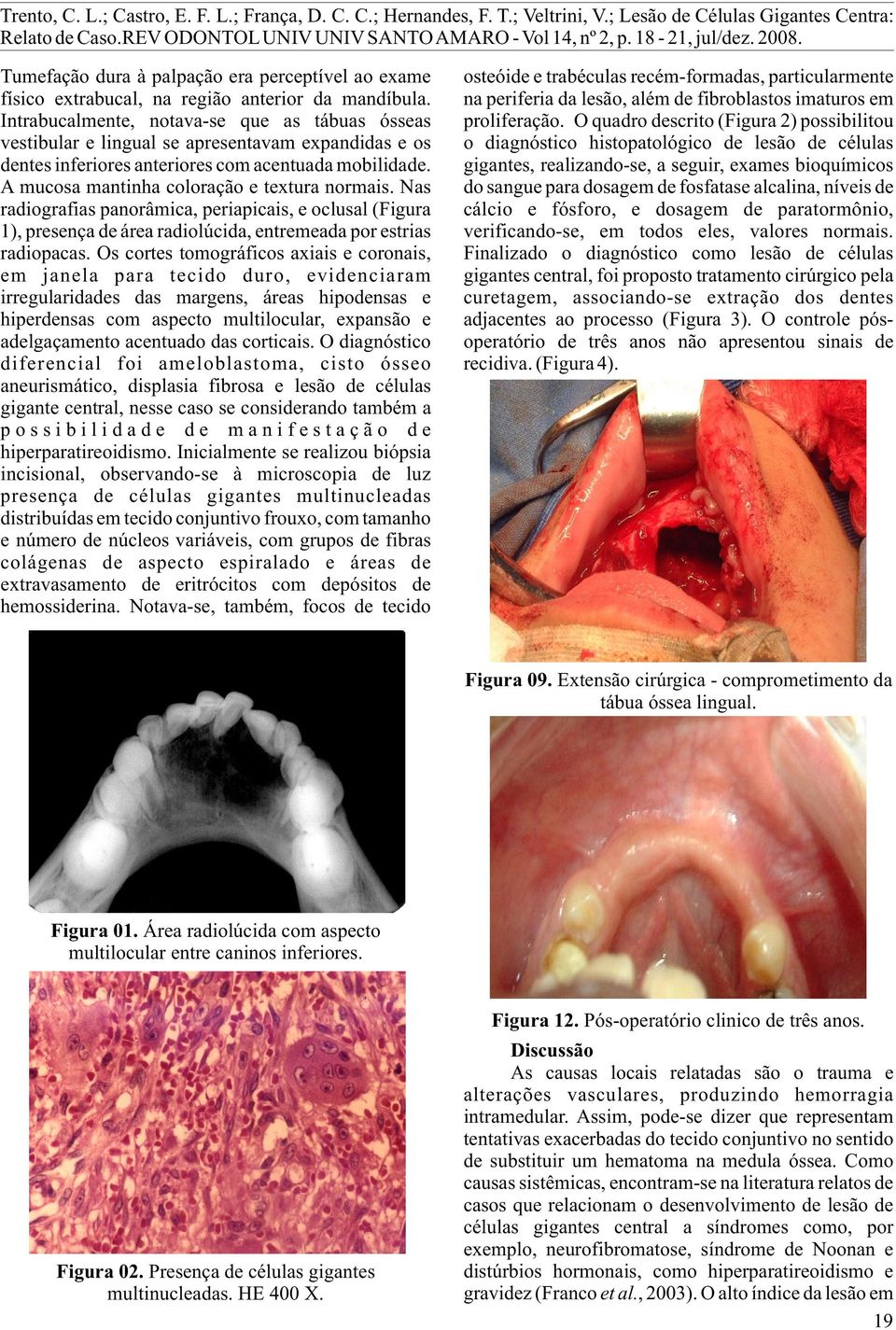 Intrabucalmente, notava-se que as tábuas ósseas vestibular e lingual se apresentavam expandidas e os dentes inferiores anteriores com acentuada mobilidade.