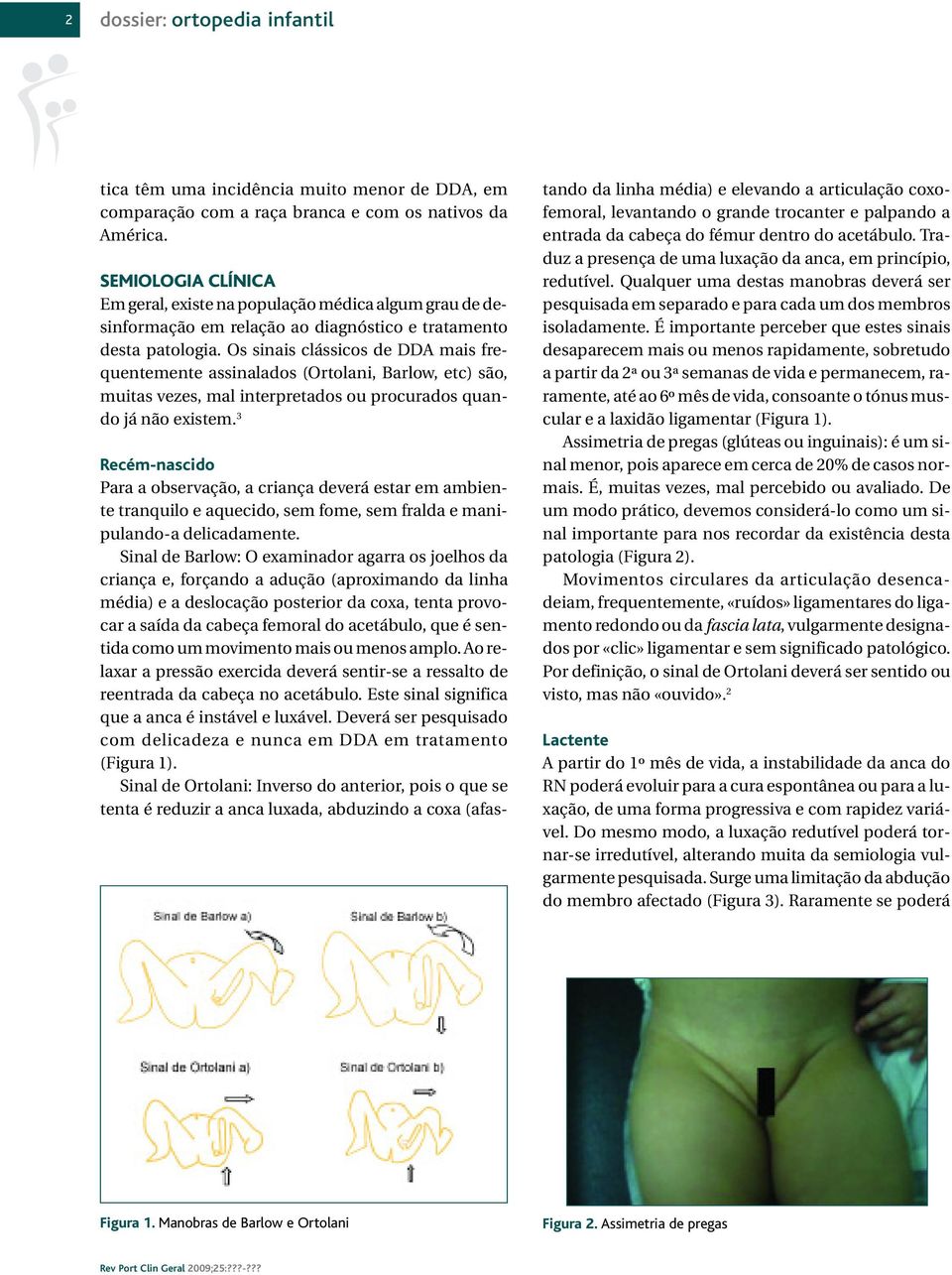 Os sinais clássicos de DDA mais frequentemente assinalados (Ortolani, Barlow, etc) são, muitas vezes, mal interpretados ou procurados quando já não existem.