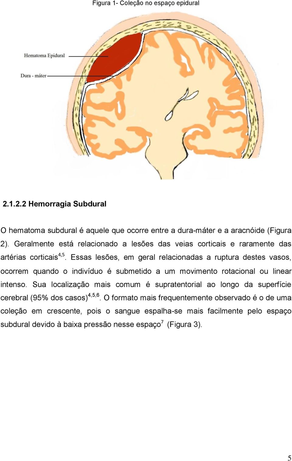 Essas lesões, em geral relacionadas a ruptura destes vasos, ocorrem quando o indivíduo é submetido a um movimento rotacional ou linear intenso.