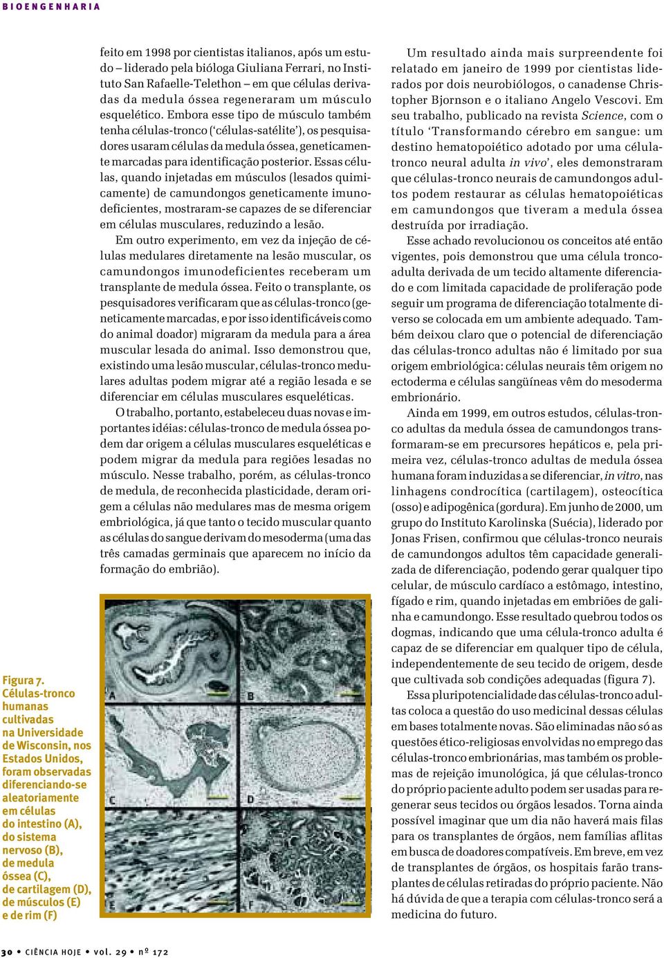 óssea (C), de cartilagem (D), de músculos (E) e de rim (F) feito em 1998 por cientistas italianos, após um estudo liderado pela bióloga Giuliana Ferrari, no Instituto San Rafaelle-Telethon em que