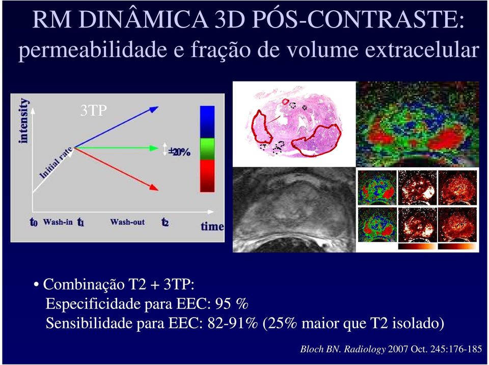 Especificidade para EEC: 95 % Sensibilidade para EEC: