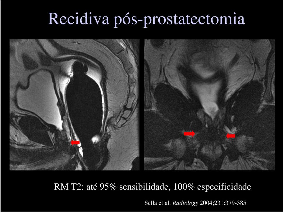 100% especificidade Sella et