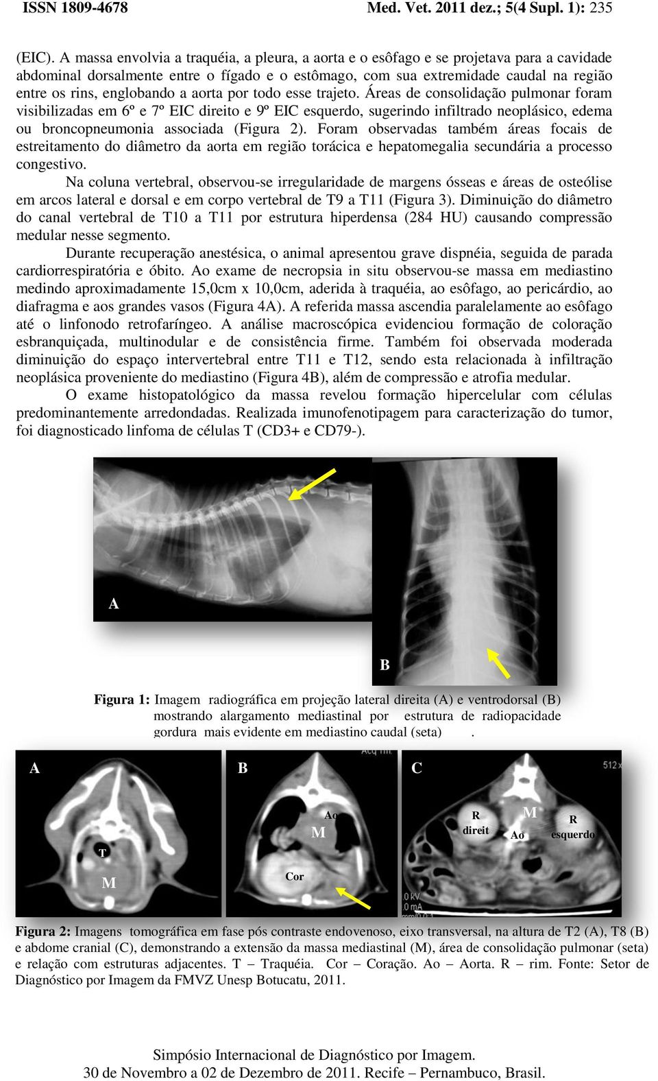 englobando a aorta por todo esse trajeto.