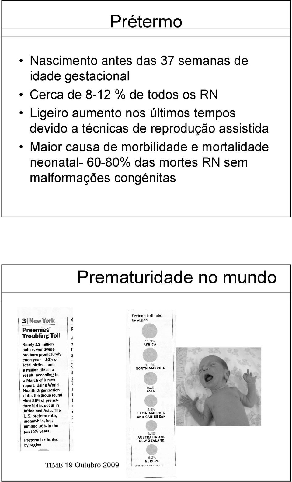 reprodução assistida Maior causa de morbilidade e mortalidade neonatal- 60-80%