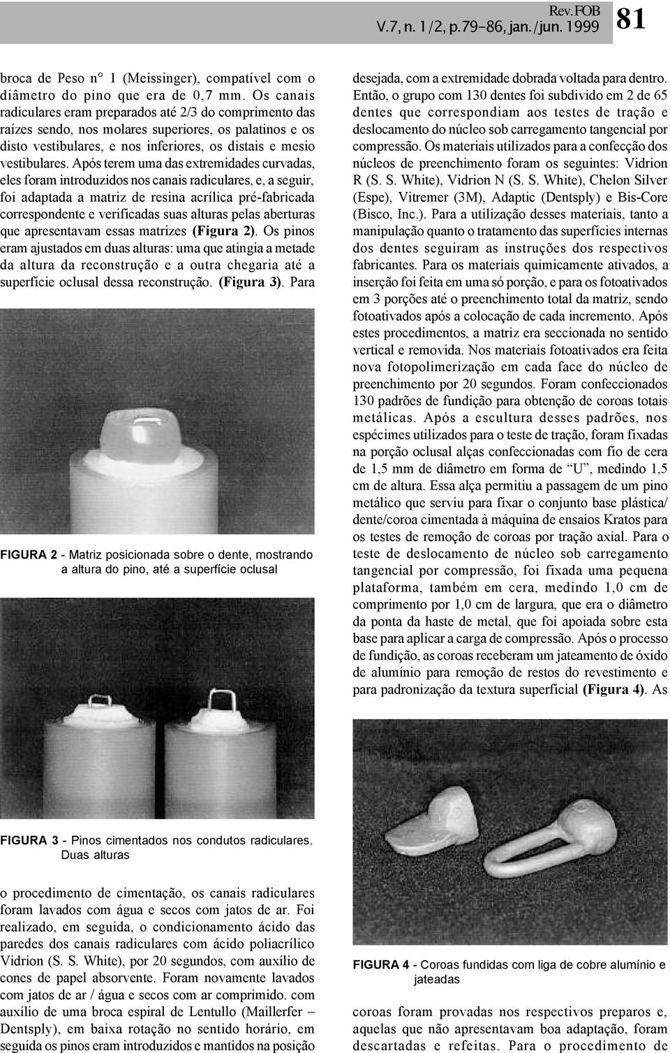 Após terem uma das extremidades curvadas, eles foram introduzidos nos canais radiculares, e, a seguir, foi adaptada a matriz de resina acrílica pré-fabricada correspondente e verificadas suas alturas