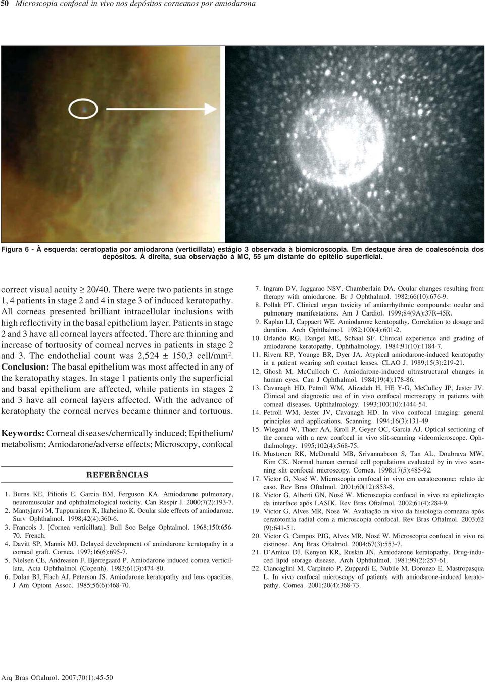 There were two patients in stage 1, 4 patients in stage 2 and 4 in stage 3 of induced keratopathy.