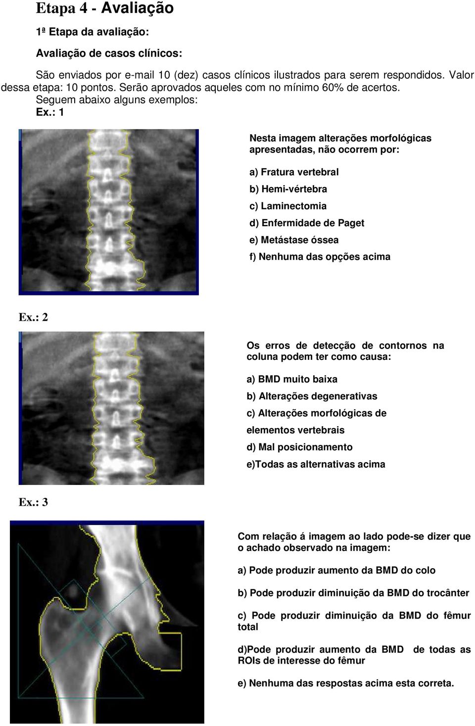 : 1 Nesta imagem alterações morfológicas apresentadas, não ocorrem por: a) Fratura vertebral b) Hemi-vértebra c) Laminectomia d) Enfermidade de Paget e) Metástase óssea f) Nenhuma das opções acima Ex.