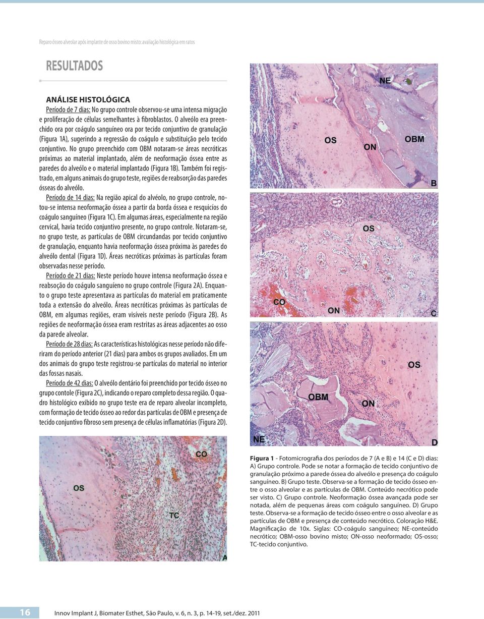 O alveólo era preenchido ora por coágulo sanguíneo ora por tecido conjuntivo de granulação (Figura 1A), sugerindo a regressão do coágulo e substituição pelo tecido conjuntivo.