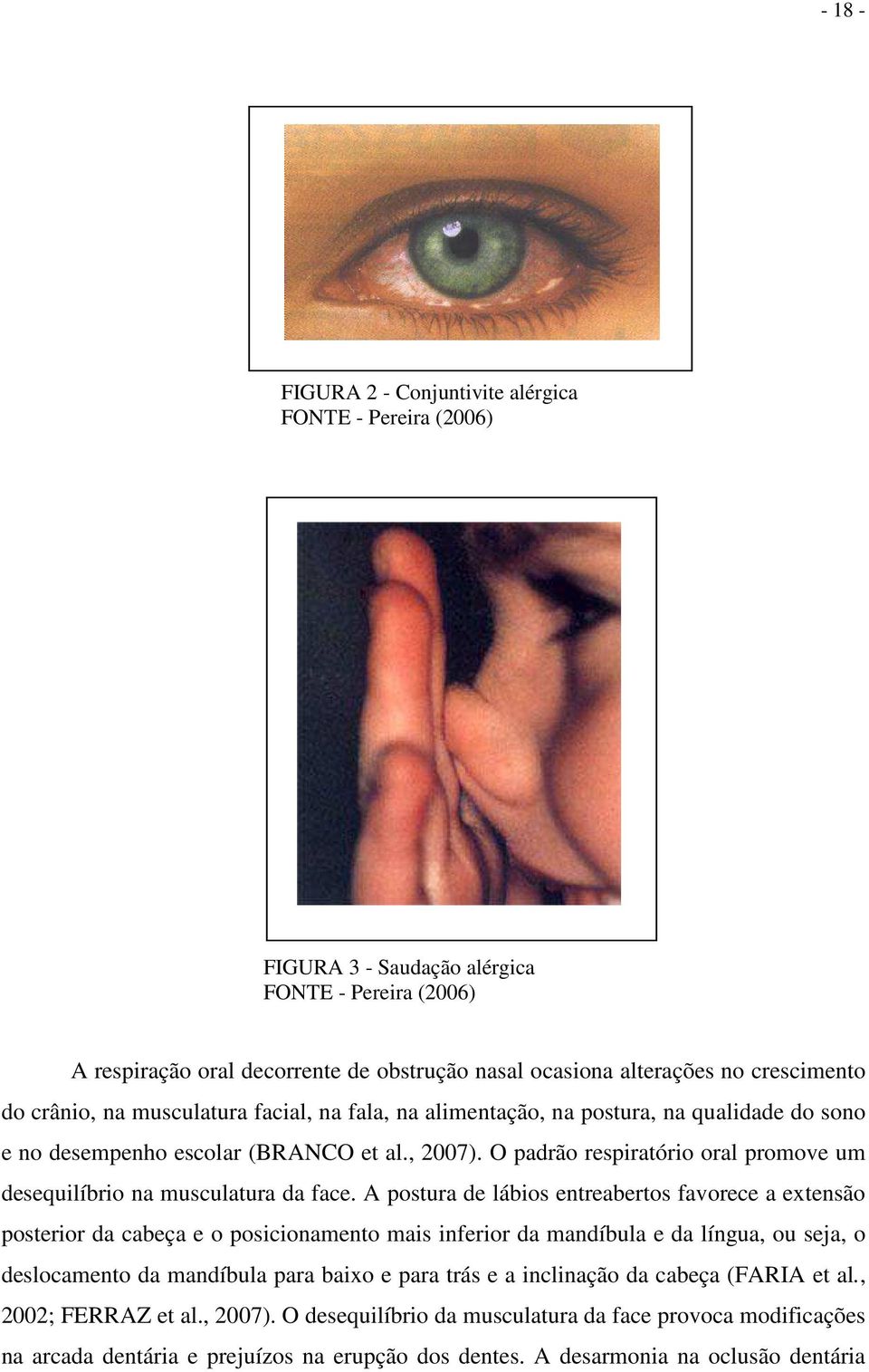 O padrão respiratório oral promove um desequilíbrio na musculatura da face.