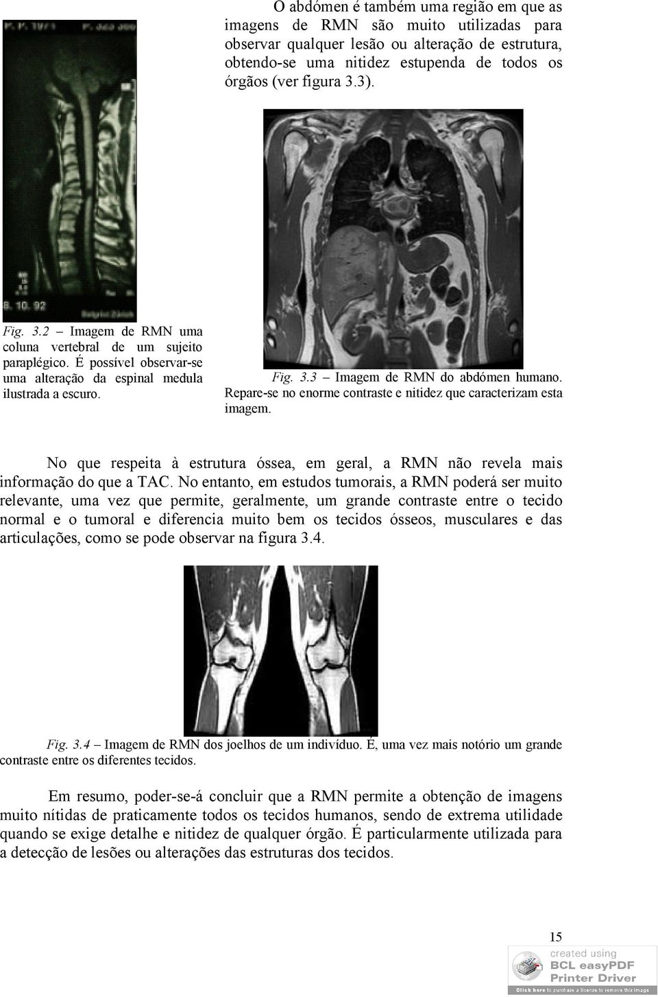 Repare-se no enorme contraste e nitidez que caracterizam esta imagem. No que respeita à estrutura óssea, em geral, a RMN não revela mais informação do que a TAC.