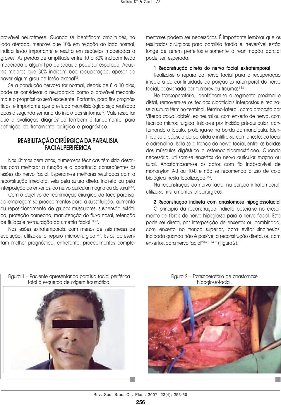 As perdas de amplitude entre 10 a 30% indicam lesão moderada e algum tipo de seqüela pode ser esperado. Aquelas maiores que 30% indicam boa recuperação, apesar de haver algum grau de lesão axonal 12.