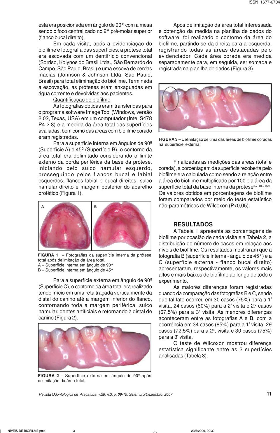 , São Bernardo do Campo, São Paulo, Brasil) e uma escova de cerdas macias (Johnson & Johnson Ltda, São Paulo, Brasil) para total eliminação do biofilme.