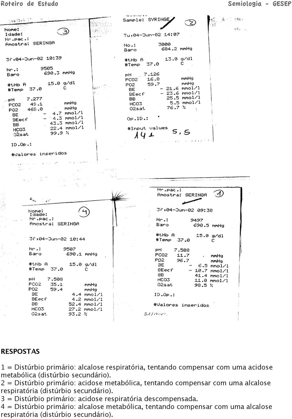 2 = Distúrbio primário: acidose metabólica, tentando compensar com uma alcalose respiratória  3 =