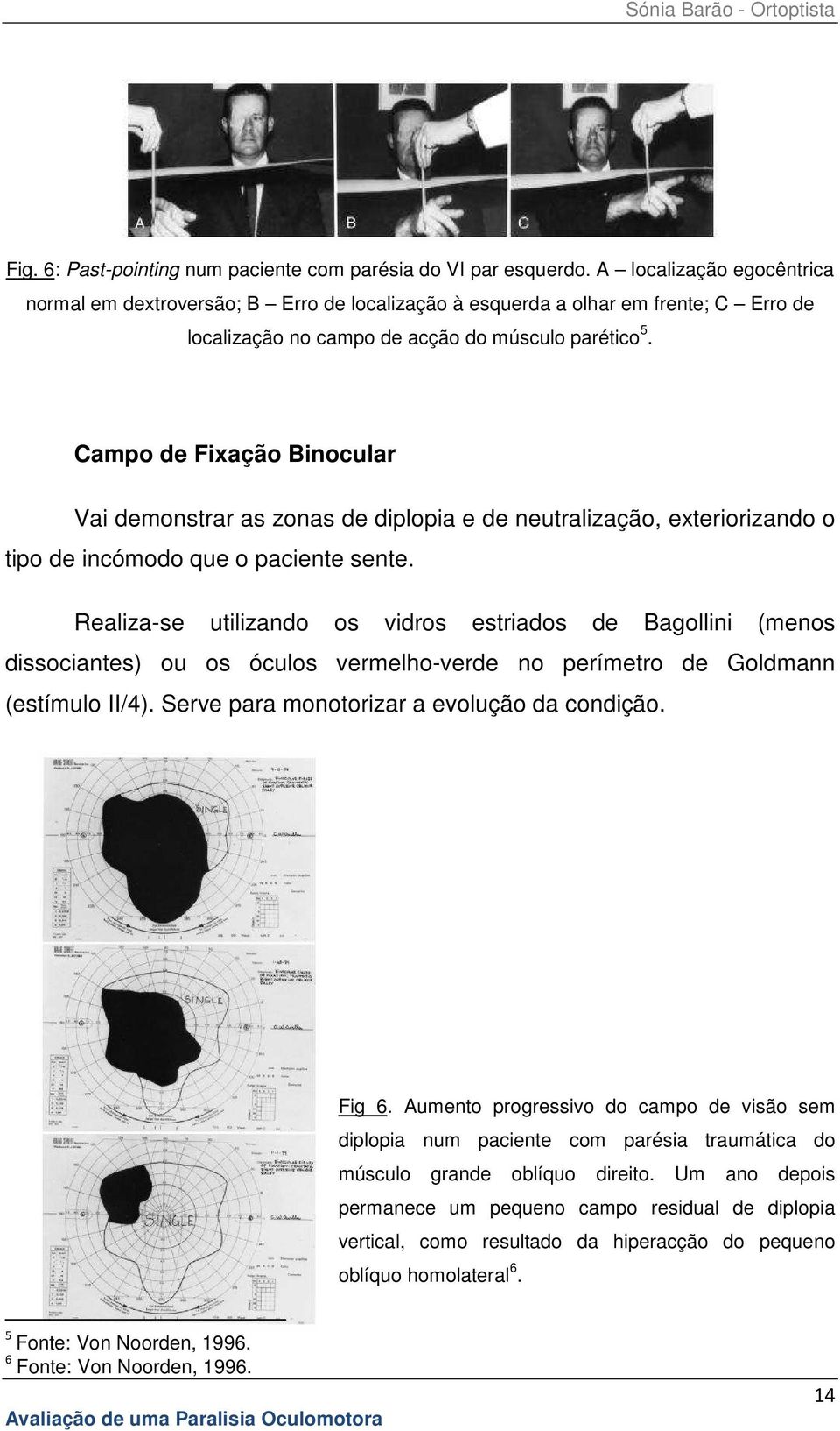 Campo de Fixação Binocular Vai demonstrar as zonas de diplopia e de neutralização, exteriorizando o tipo de incómodo que o paciente sente.