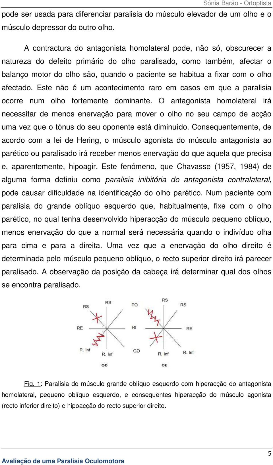 fixar com o olho afectado. Este não é um acontecimento raro em casos em que a paralisia ocorre num olho fortemente dominante.