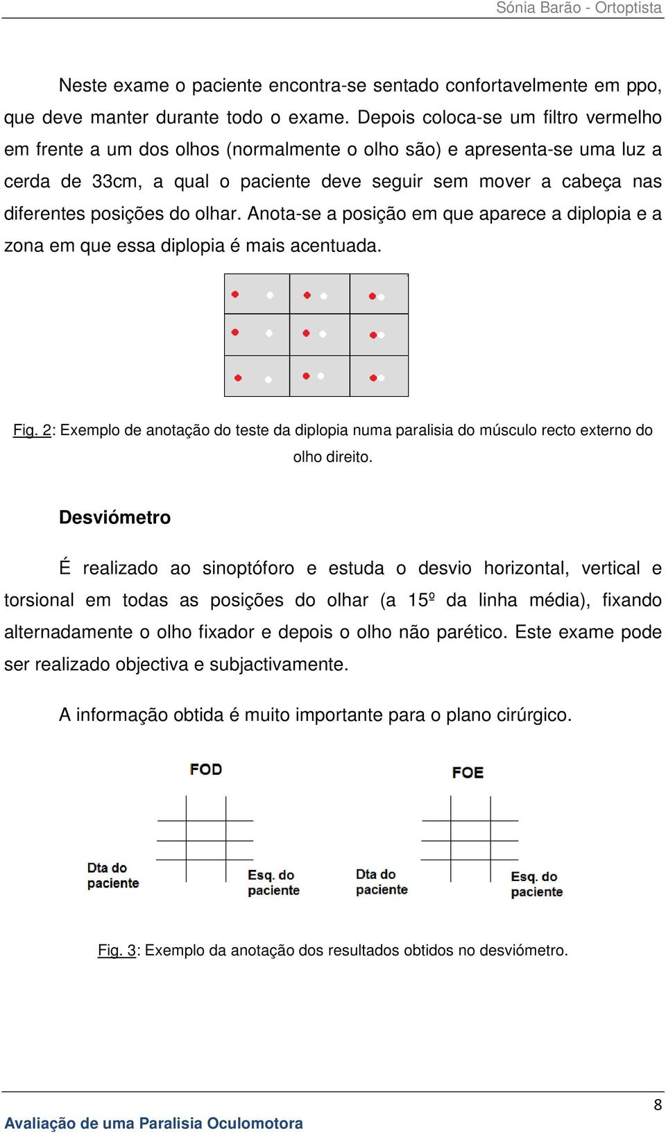 do olhar. Anota-se a posição em que aparece a diplopia e a zona em que essa diplopia é mais acentuada. Fig.