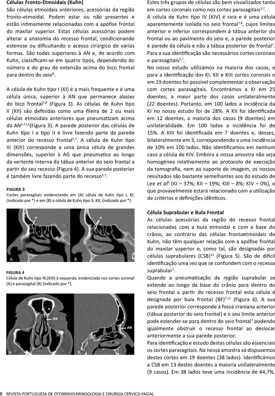 Estas células acessórias podem alterar a anatomia do recesso frontal, condicionando estenose ou dificultando o acesso cirúrgico de várias formas.