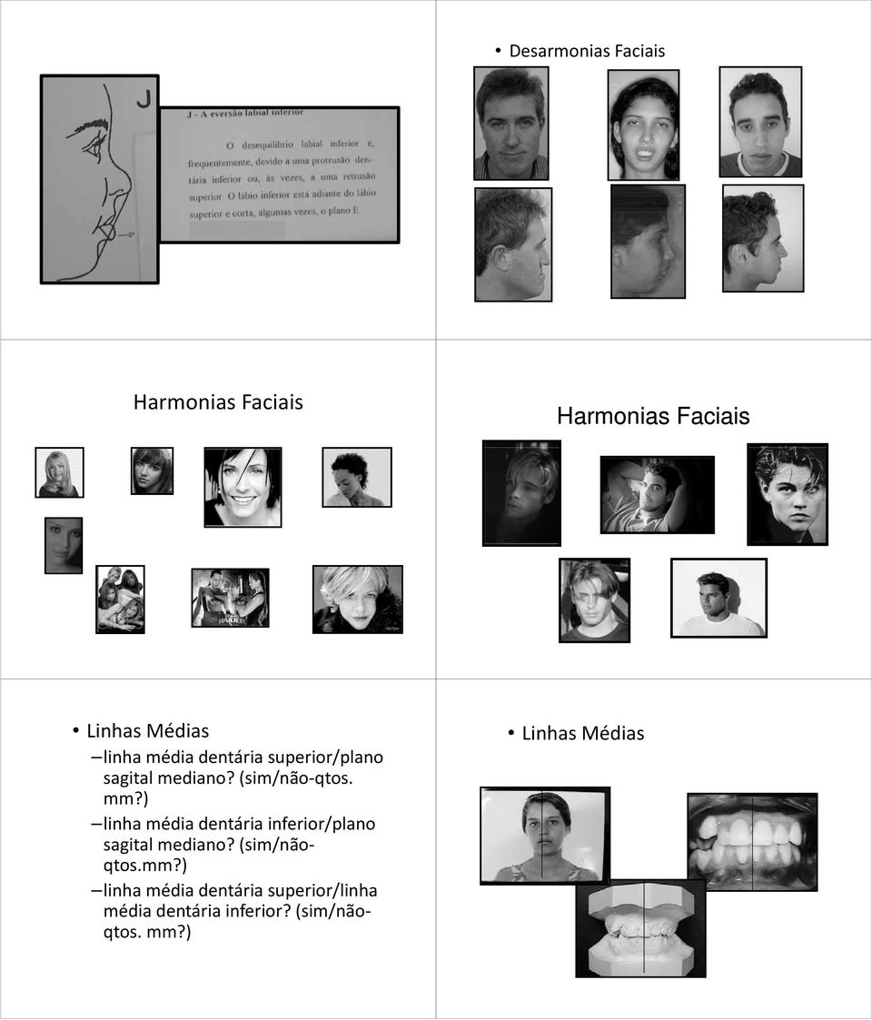 ) linha médiadentáriainferior/plano dentária inferior/plano sagital mediano?