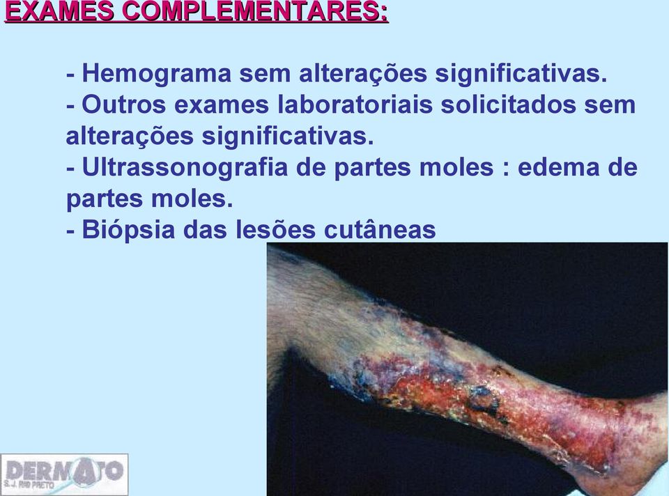 - Outros exames laboratoriais solicitados sem alterações