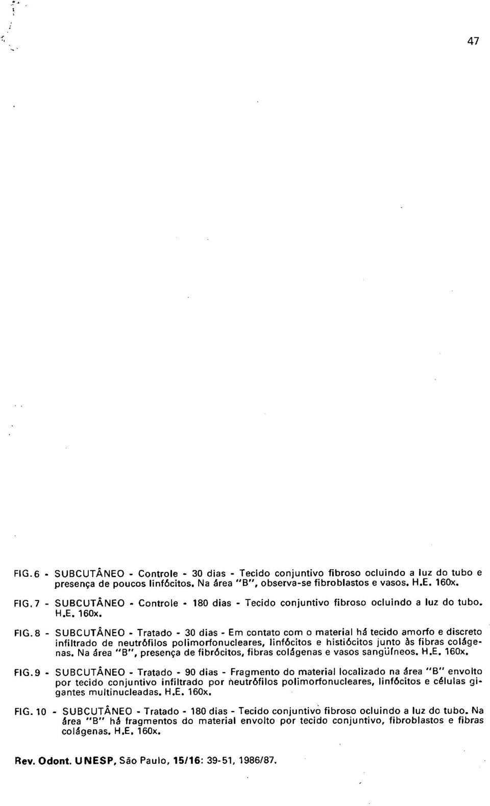 8 - SUBCUTÂNEO - Tratado - 30 dias - Em cantata com o material há tecido amorfo e discreto infiltrado de neutrófilos polimorfonucleares, linfócitos e histiócitos junto às fibras colágenas.