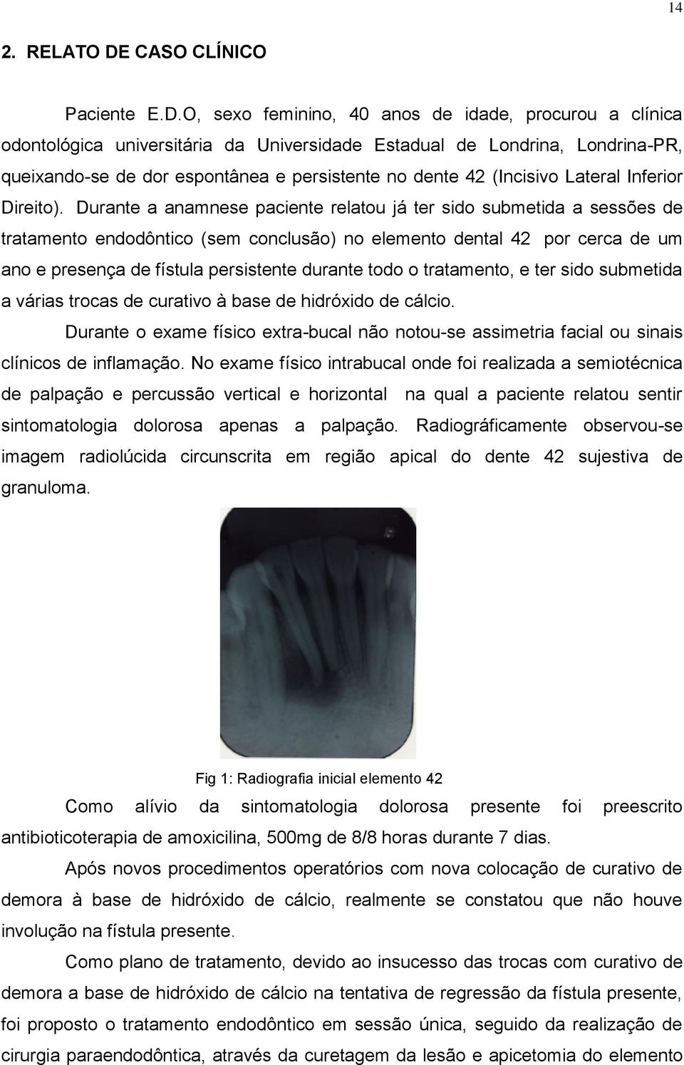 O, sexo feminino, 40 anos de idade, procurou a clínica odontológica universitária da Universidade Estadual de Londrina, Londrina-PR, queixando-se de dor espontânea e persistente no dente 42 (Incisivo