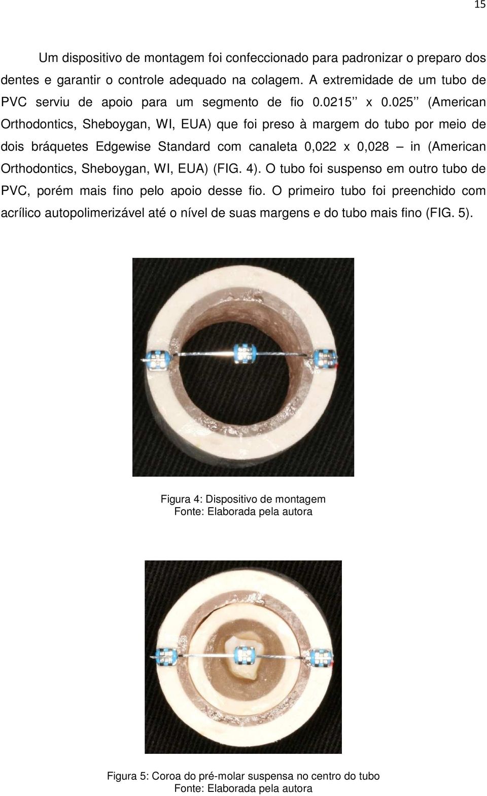 025 (American Orthodontics, Sheboygan, WI, EUA) que foi preso à margem do tubo por meio de dois bráquetes Edgewise Standard com canaleta 0,022 x 0,028 in (American Orthodontics, Sheboygan,