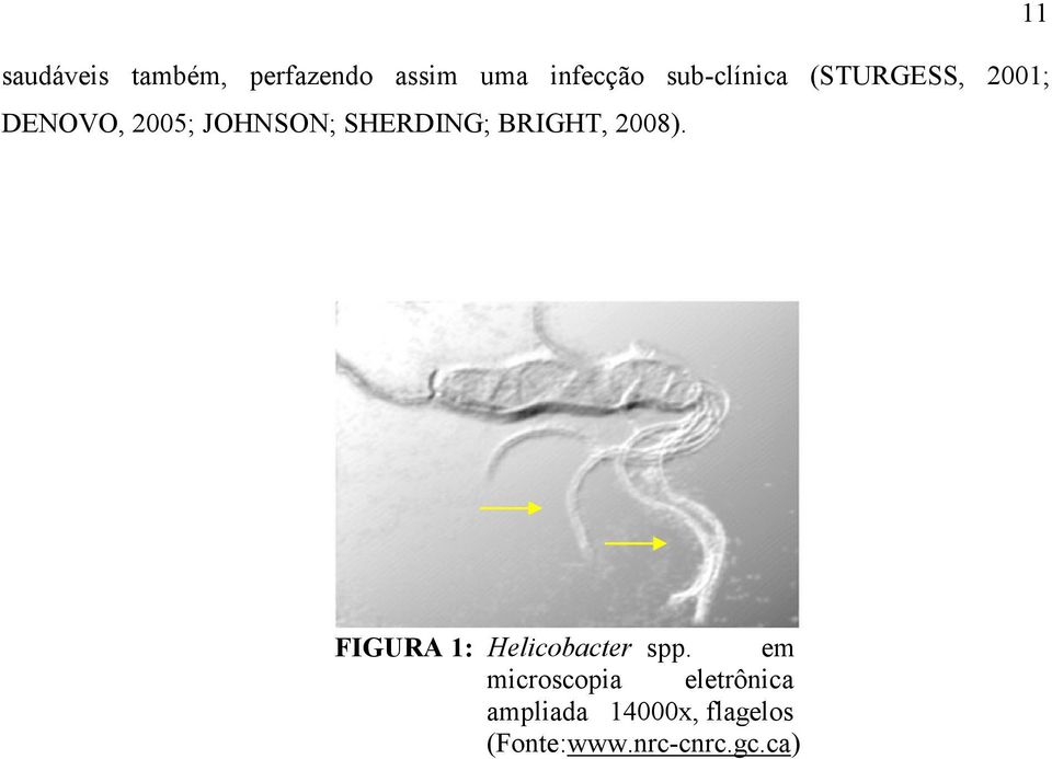 SHERDING; BRIGHT, 2008). 11 FIGURA 1: Helicobacter spp.
