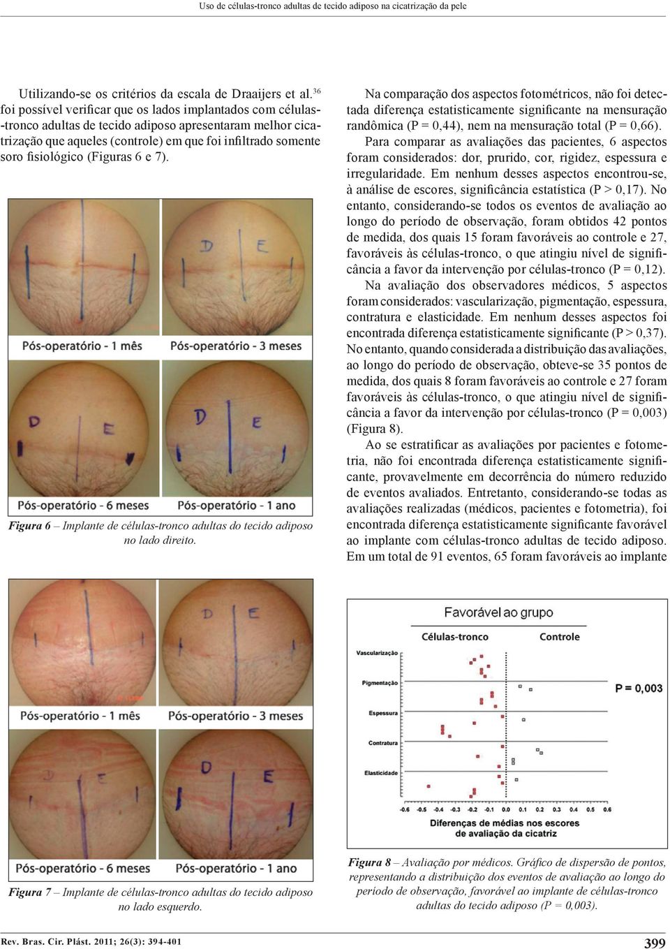 fisiológico (Figuras 6 e 7). Figura 6 Implante de células-tronco adultas do tecido adiposo no lado direito.