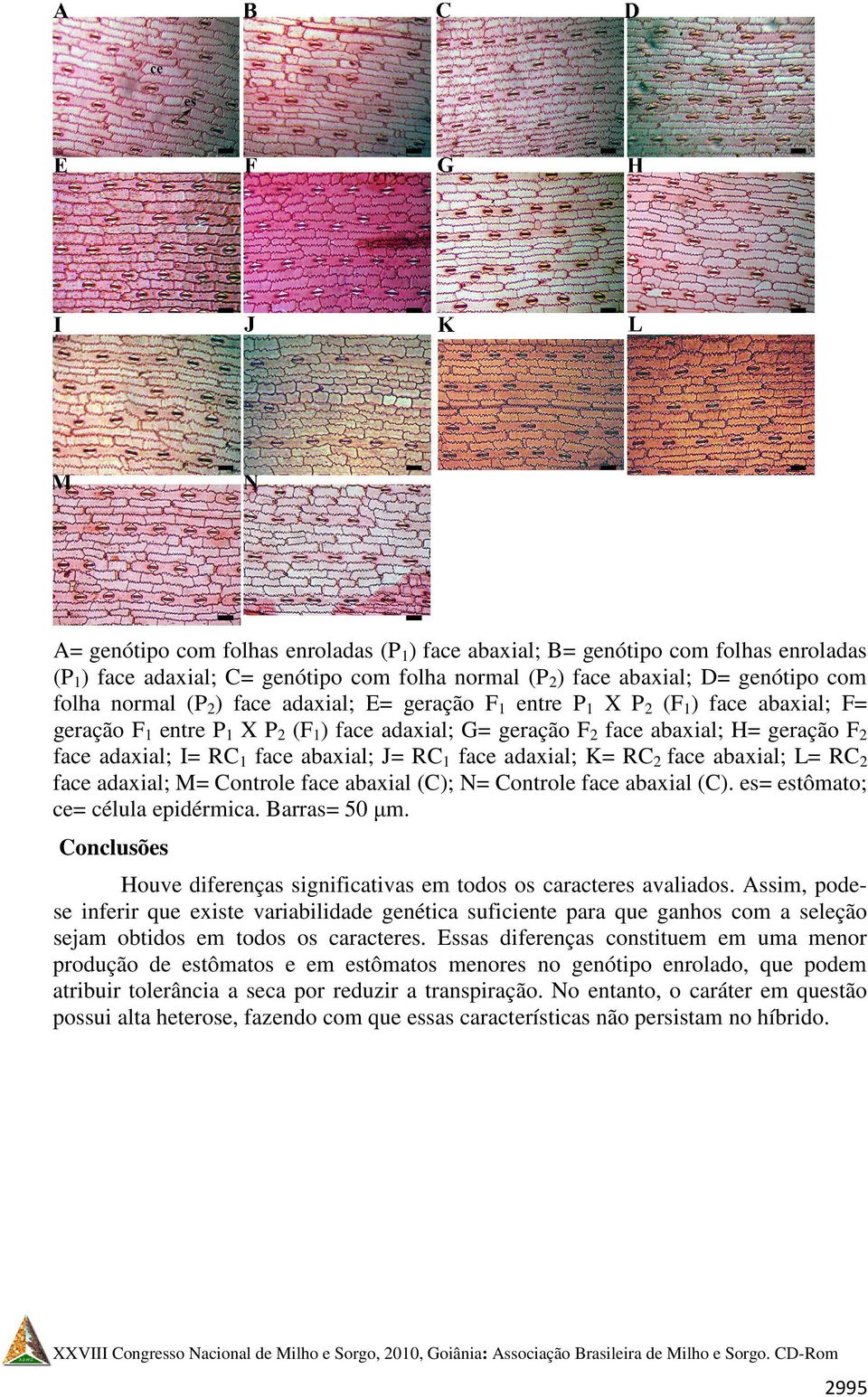 face abaxial; L= RC2 face adaxial; M= Controle face abaxial (C); N= Controle face abaxial (C). es= estômato; ce= célula epidérmica. Barras= 50 µm.