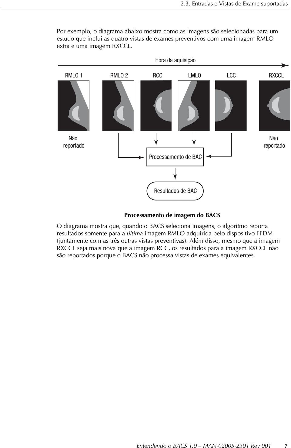 Hora da aquisição RMLO 1 RMLO 2 RCC LMLO LCC RXCCL Não reportado Processamento de BAC Não reportado Resultados de BAC Processamento de imagem do BACS O diagrama mostra que, quando o BACS seleciona