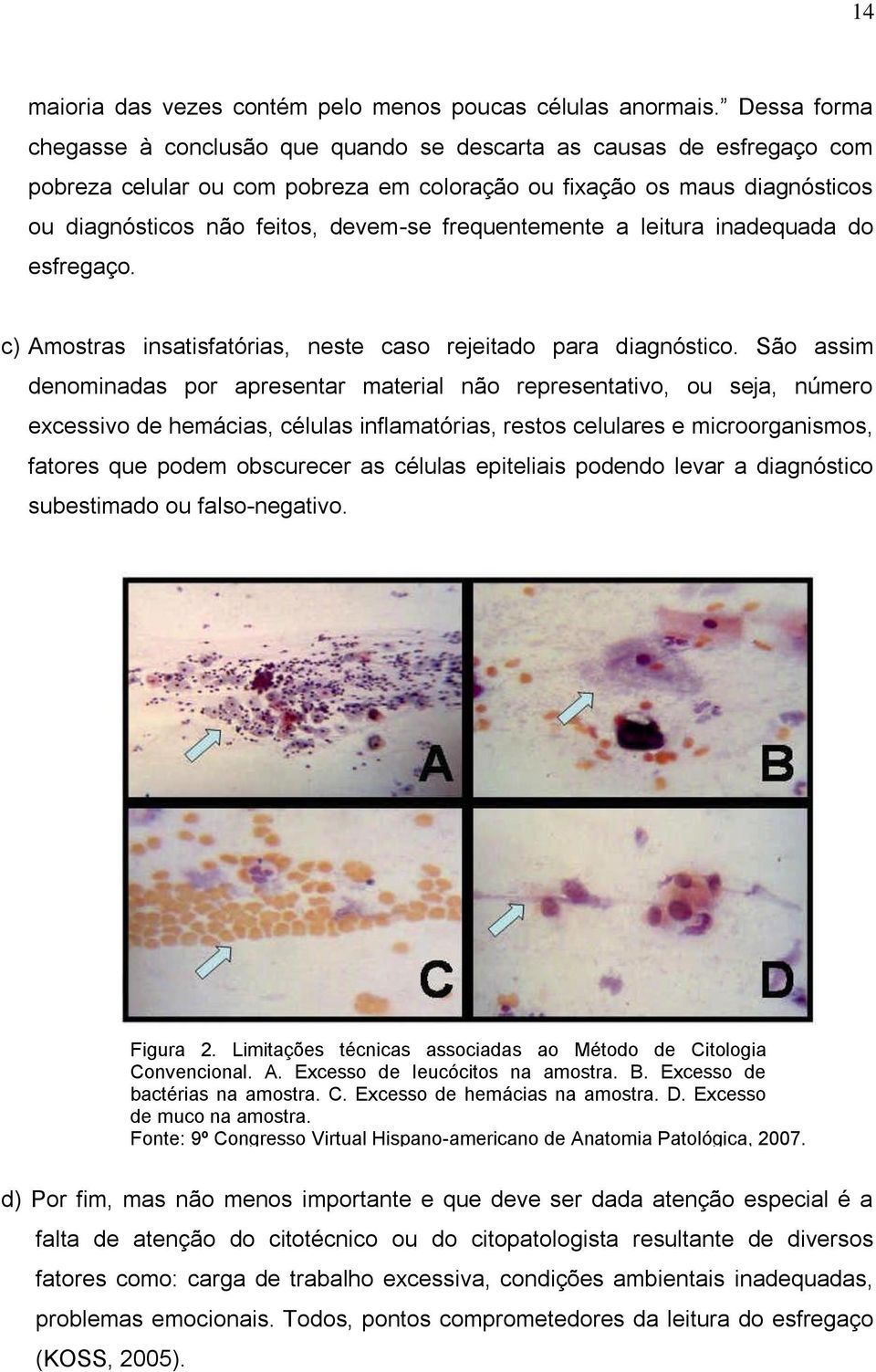 frequentemente a leitura inadequada do esfregaço. c) Amostras insatisfatórias, neste caso rejeitado para diagnóstico.