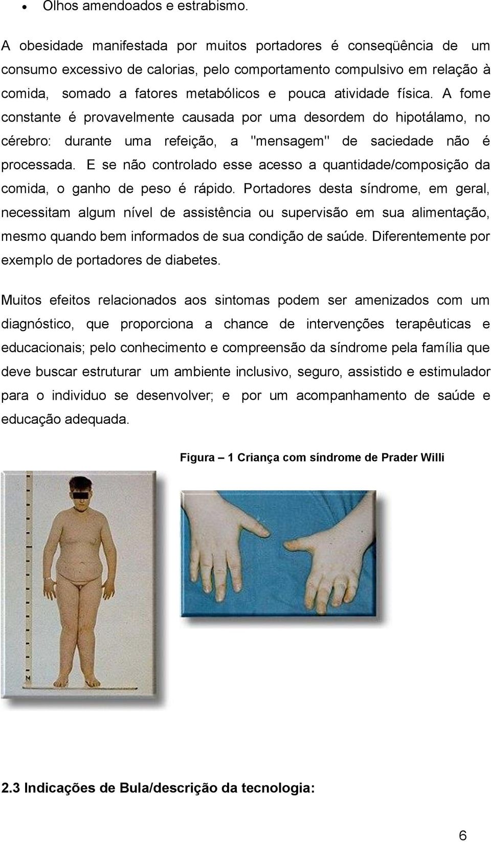 física. A fome constante é provavelmente causada por uma desordem do hipotálamo, no cérebro: durante uma refeição, a "mensagem" de saciedade não é processada.