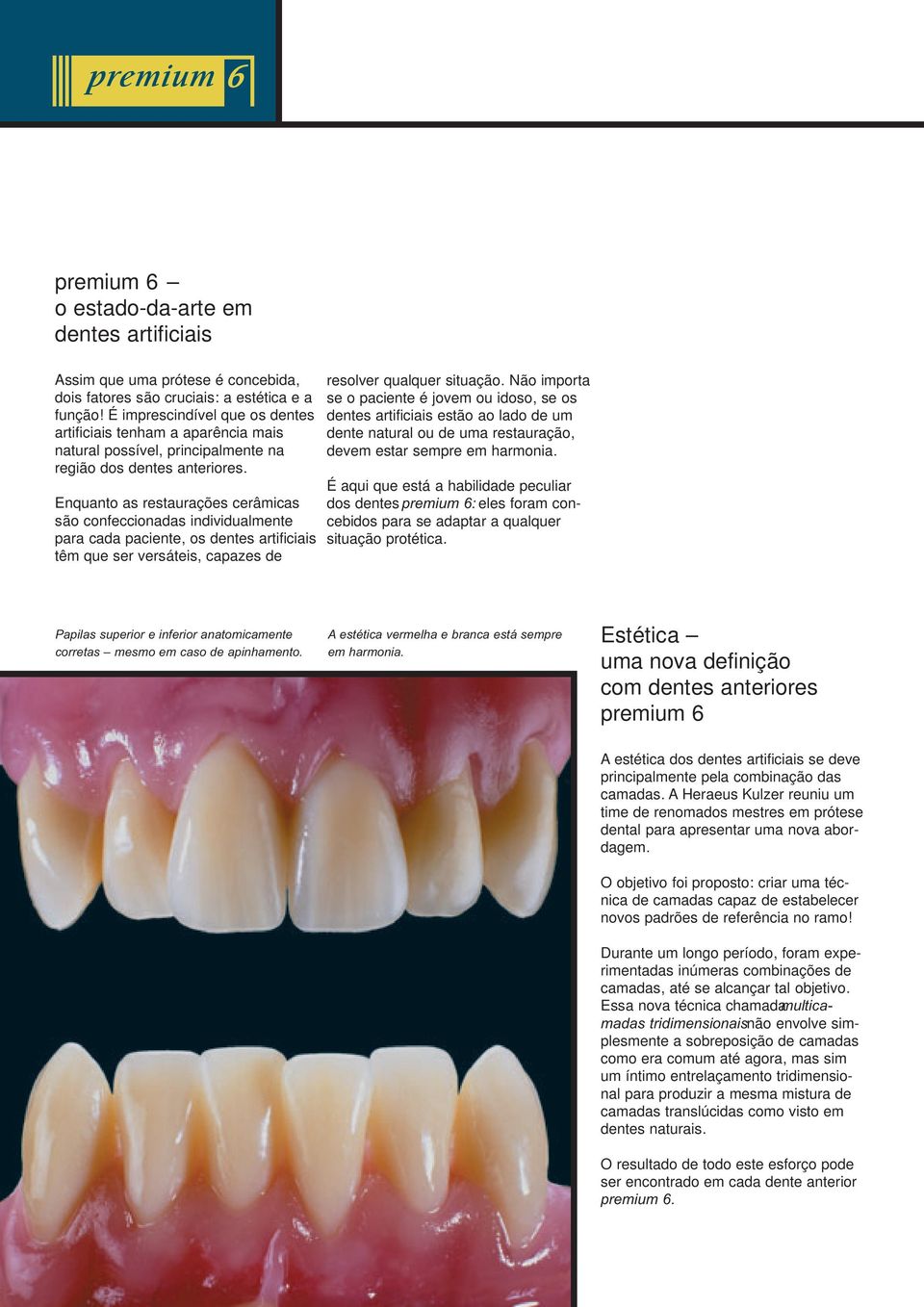 Enquanto as restaurações cerâmicas são confeccionadas individualmente para cada paciente, os dentes artificiais têm que ser versáteis, capazes de resolver qualquer situação.