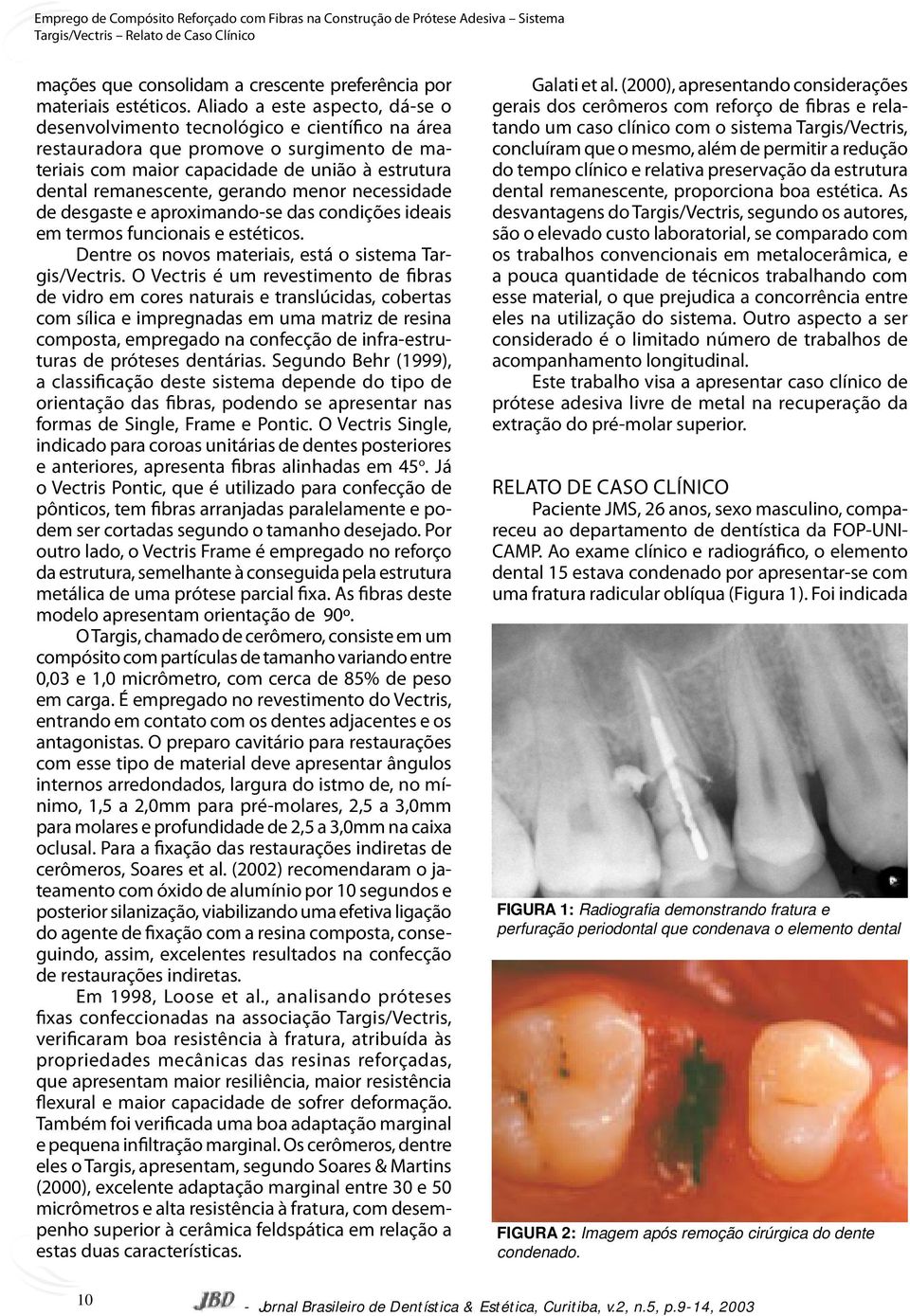 gerando menor necessidade de desgaste e aproximando-se das condições ideais em termos funcionais e estéticos. Dentre os novos materiais, está o sistema Targis/Vectris.