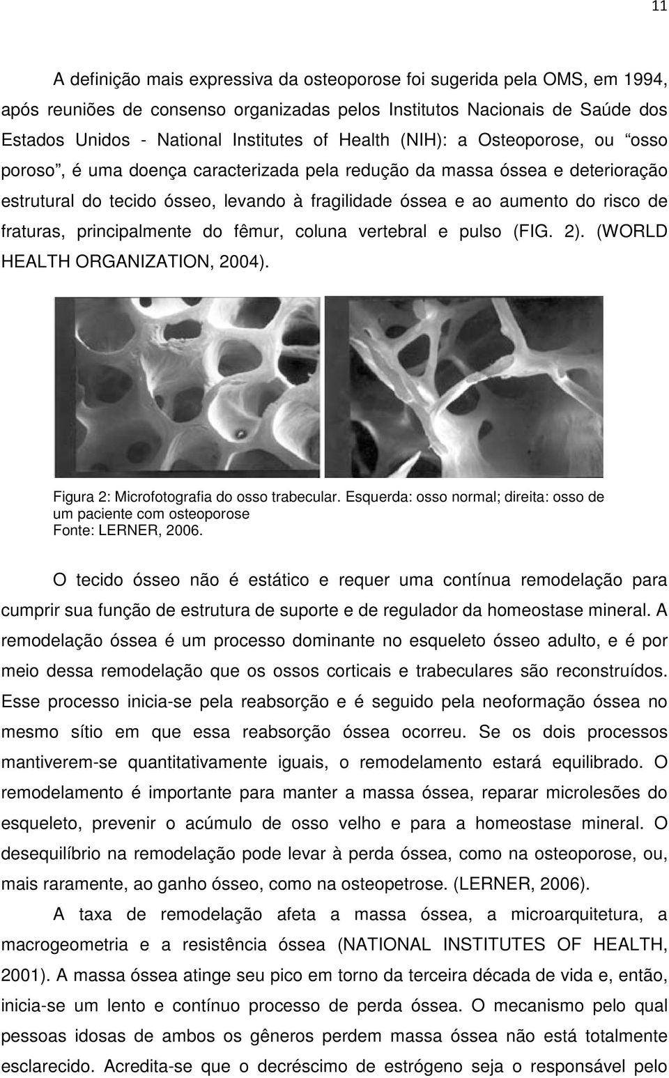 fraturas, principalmente do fêmur, coluna vertebral e pulso (FIG. 2). (WORLD HEALTH ORGANIZATION, 2004). Figura 2: Microfotografia do osso trabecular.