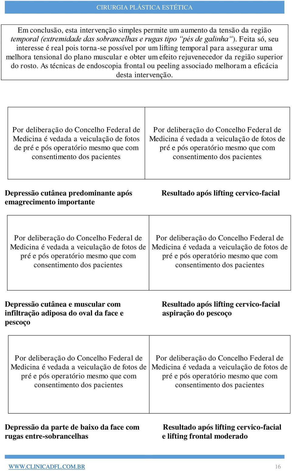 As técnicas de endoscopia frontal ou peeling associado melhoram a eficácia desta intervenção.