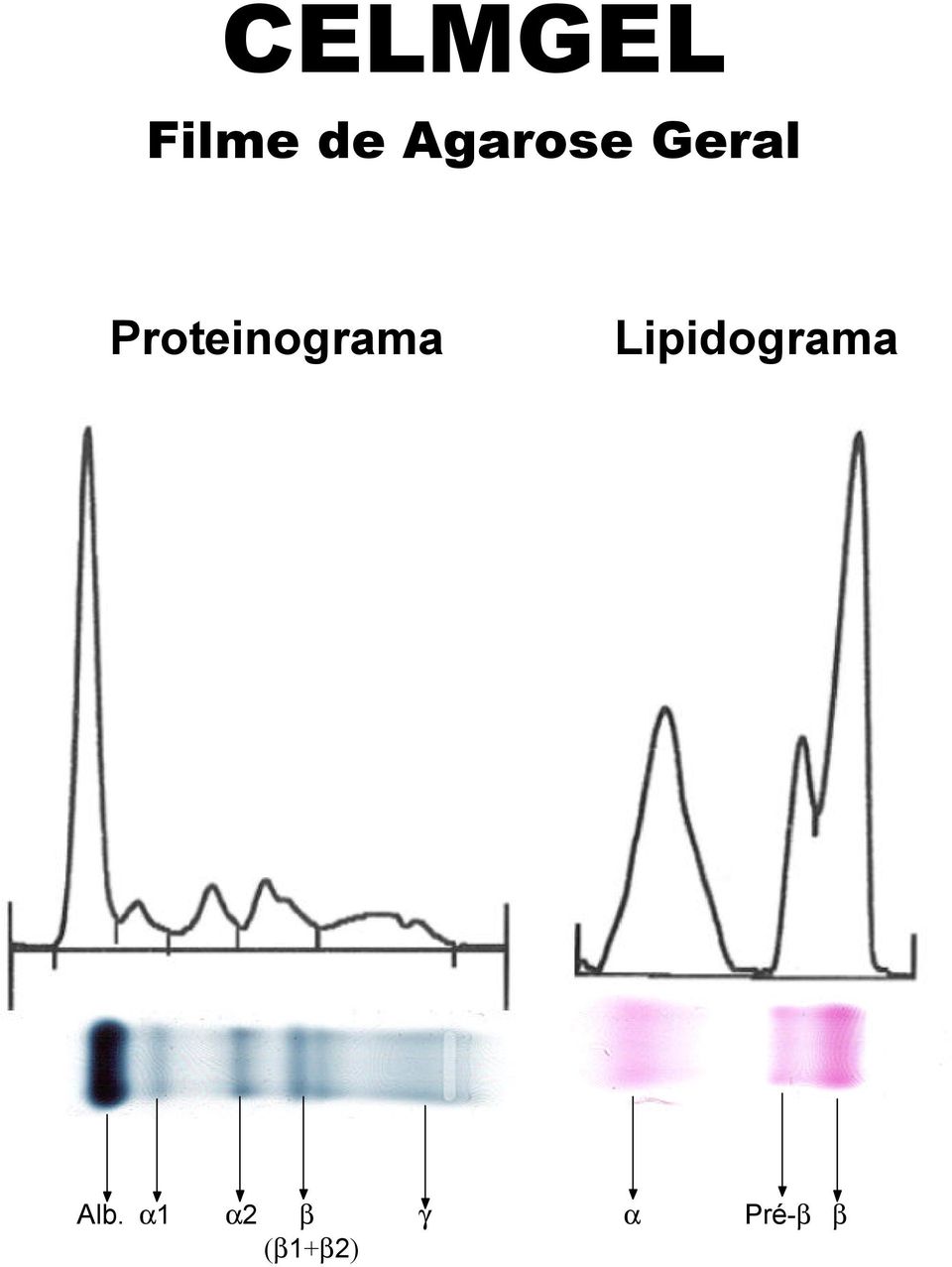 Proteinograma
