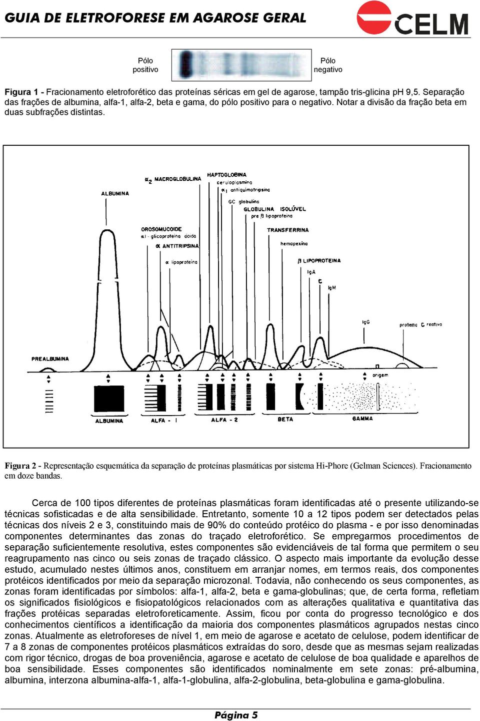 Figura 2 - Representação esquemática da separação de proteínas plasmáticas por sistema Hi-Phore (Gelman Sciences). Fracionamento em doze bandas.