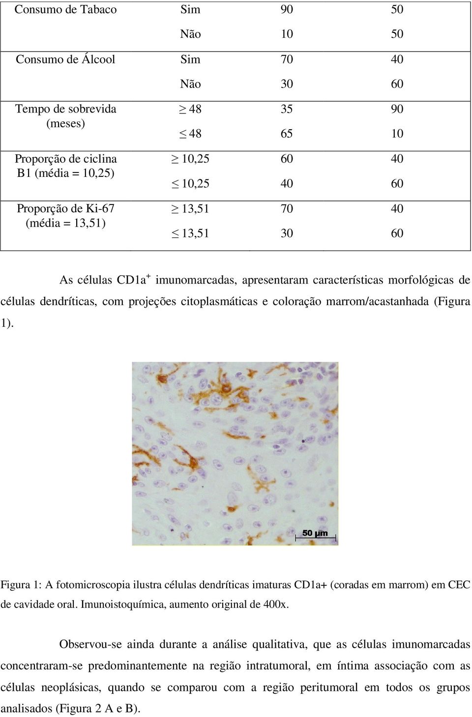 marrom/acastanhada (Figura 1). Figura 1: A fotomicroscopia ilustra células dendríticas imaturas CD1a+ (coradas em marrom) em CEC de cavidade oral. Imunoistoquímica, aumento original de 400x.