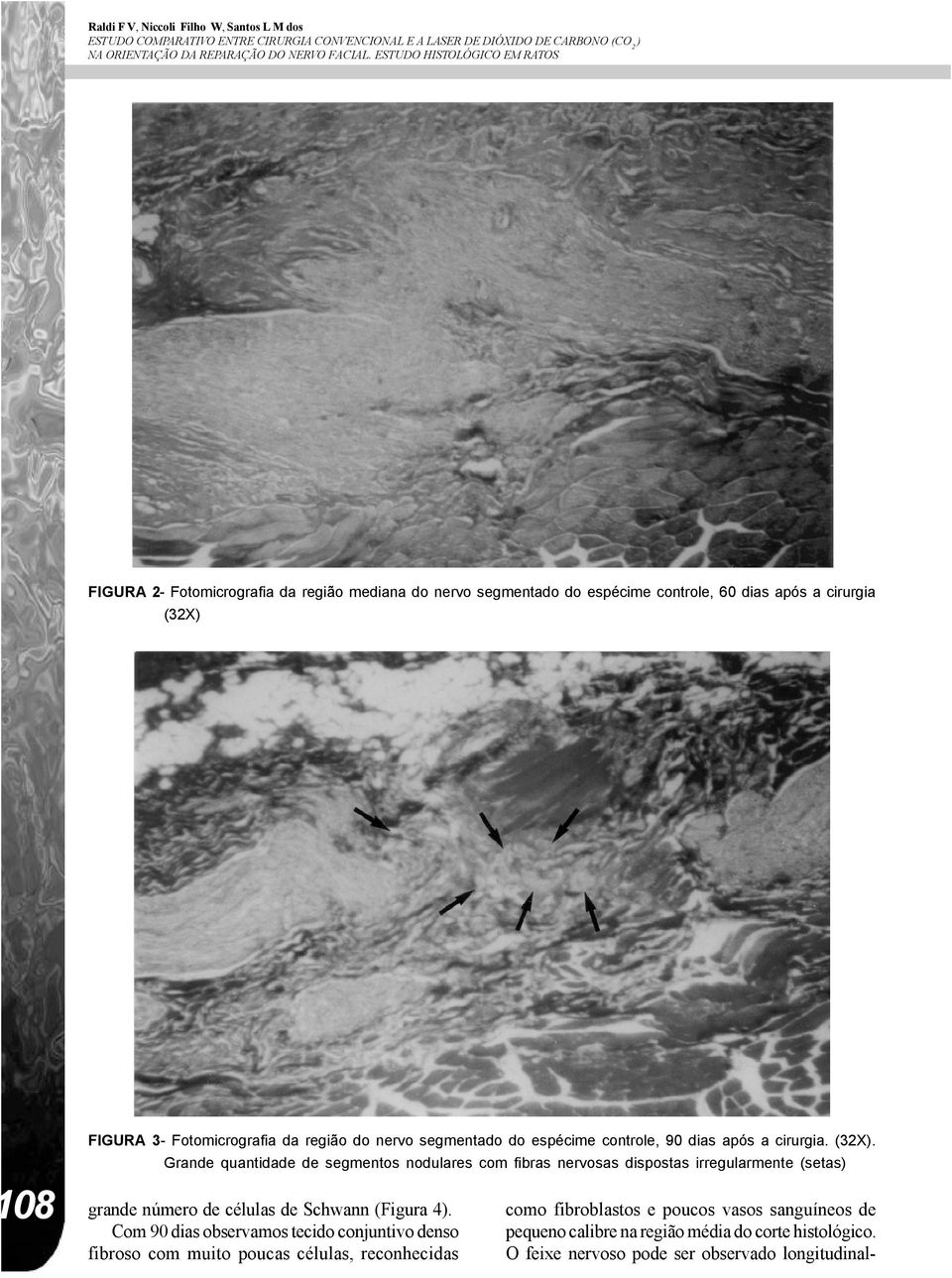 do espécime controle, 90 dias após a cirurgia. (32X). Grande quantidade de segmentos nodulares com fibras nervosas dispostas irregularmente (setas) 108 grande número de células de Schwann (Figura 4).