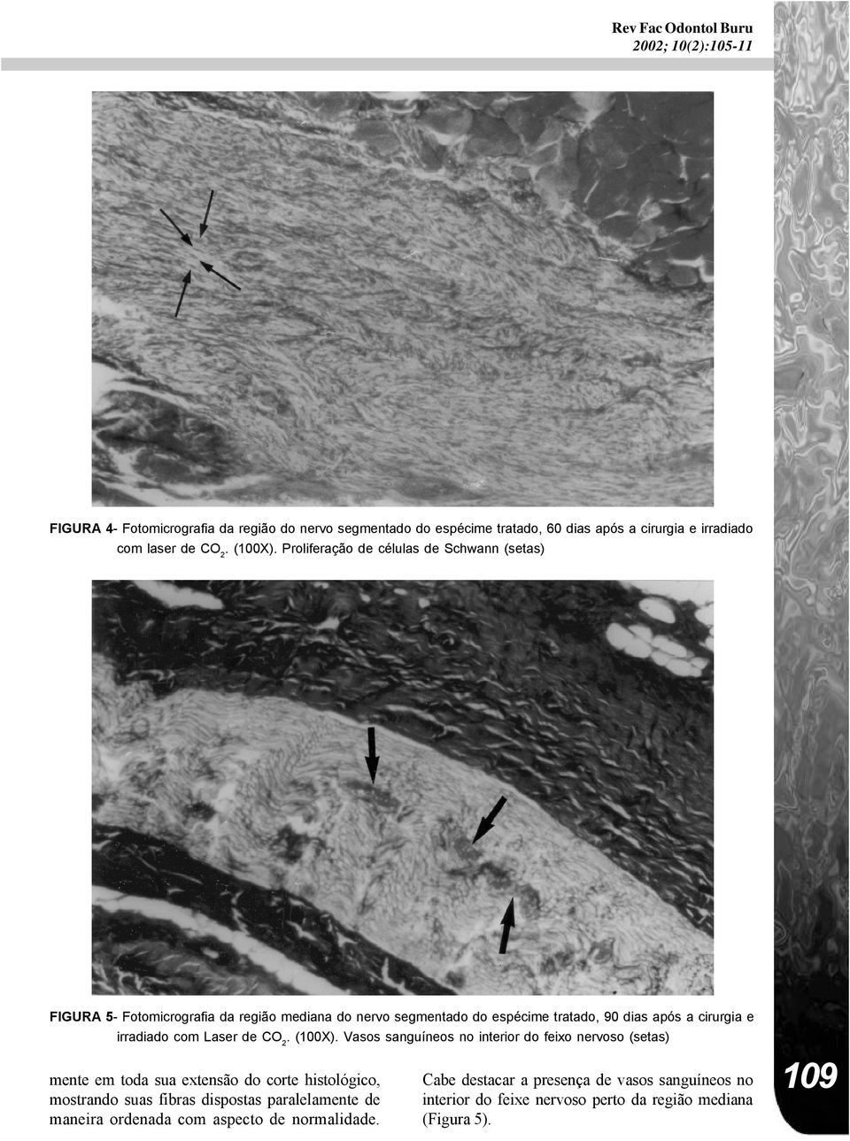 Proliferação de células de Schwann (setas) FIGURA 5- Fotomicrografia da região mediana do nervo segmentado do espécime tratado, 90 dias após a cirurgia e irradiado com