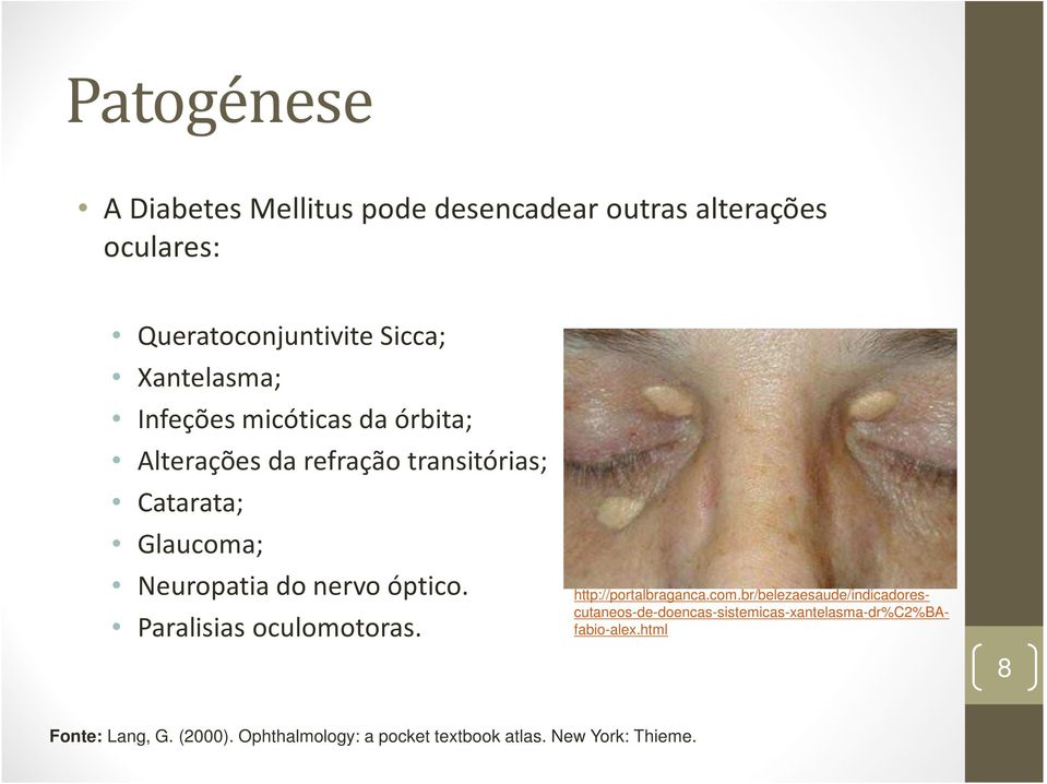 Paralisias oculomotoras. http://portalbraganca.com.
