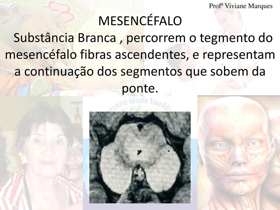 mesencéfalo fibras ascendentes, e