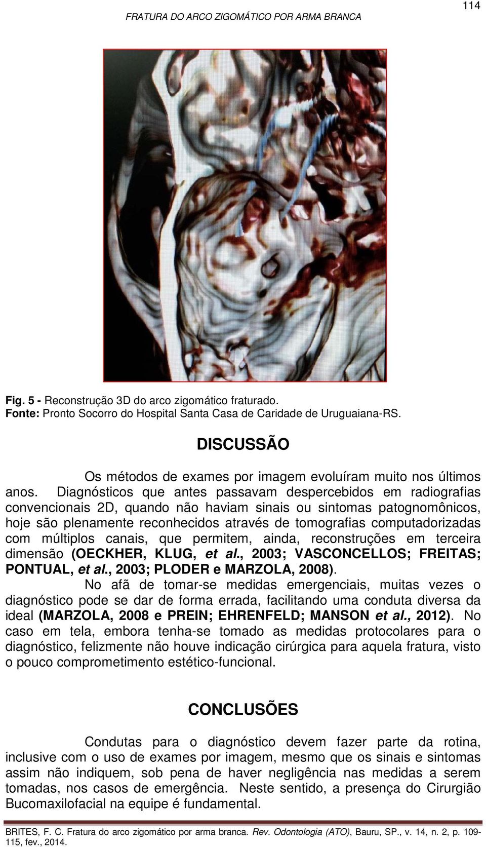 computadorizadas com múltiplos canais, que permitem, ainda, reconstruções em terceira dimensão (OECKHER, KLUG, et al., 2003; VASCONCELLOS; FREITAS; PONTUAL, et al., 2003; PLODER e MARZOLA, 2008).