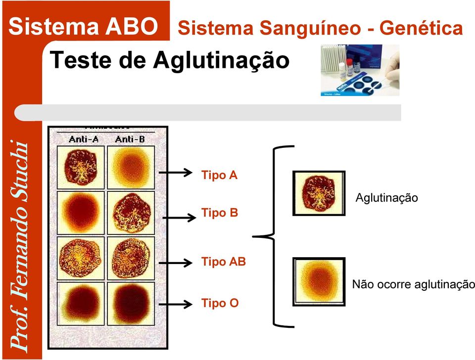 Tipo A Aglutinação Tipo B Tipo