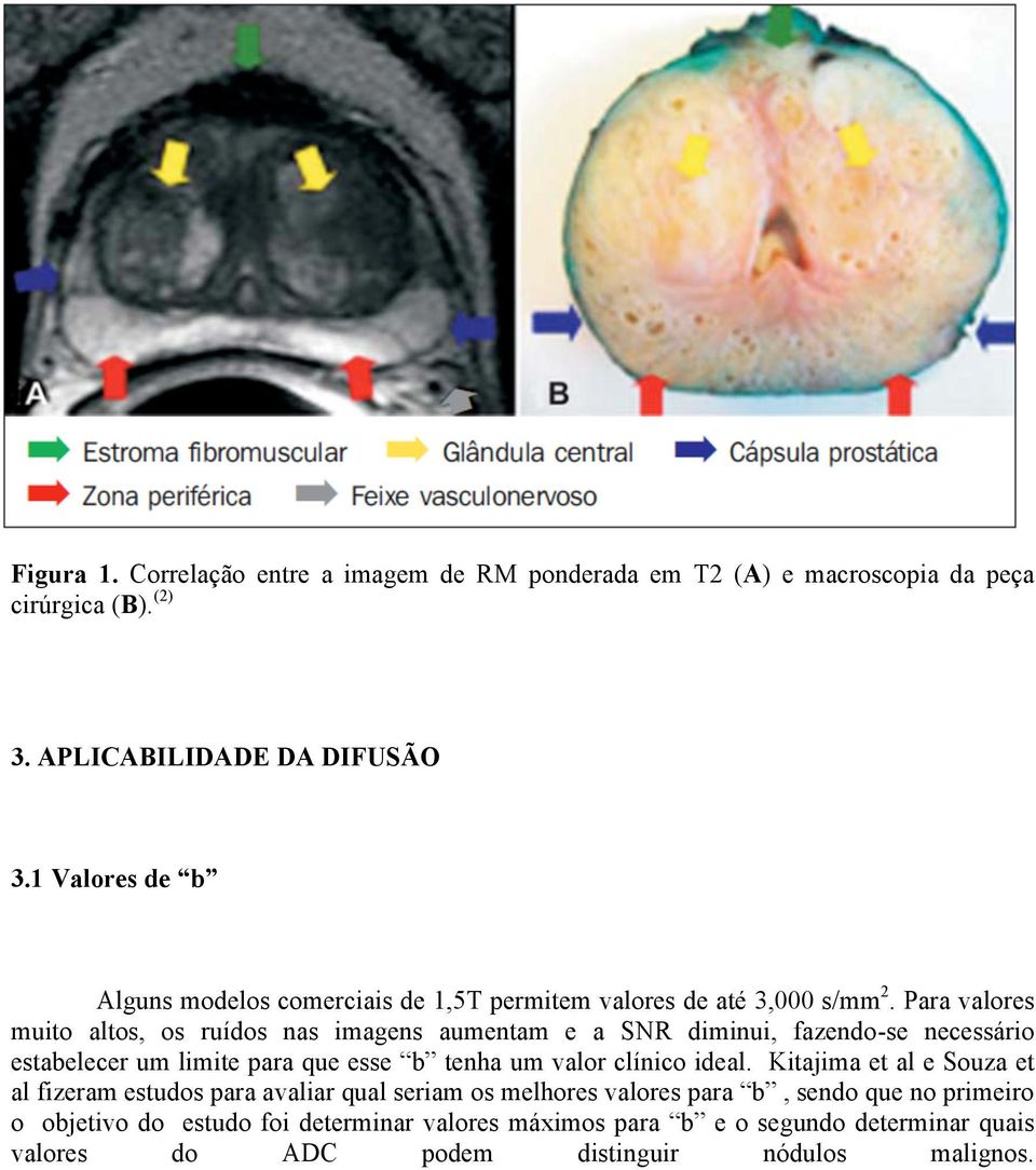 Para valores muito altos, os ruídos nas imagens aumentam e a SNR diminui, fazendo-se necessário estabelecer um limite para que esse b tenha um valor clínico