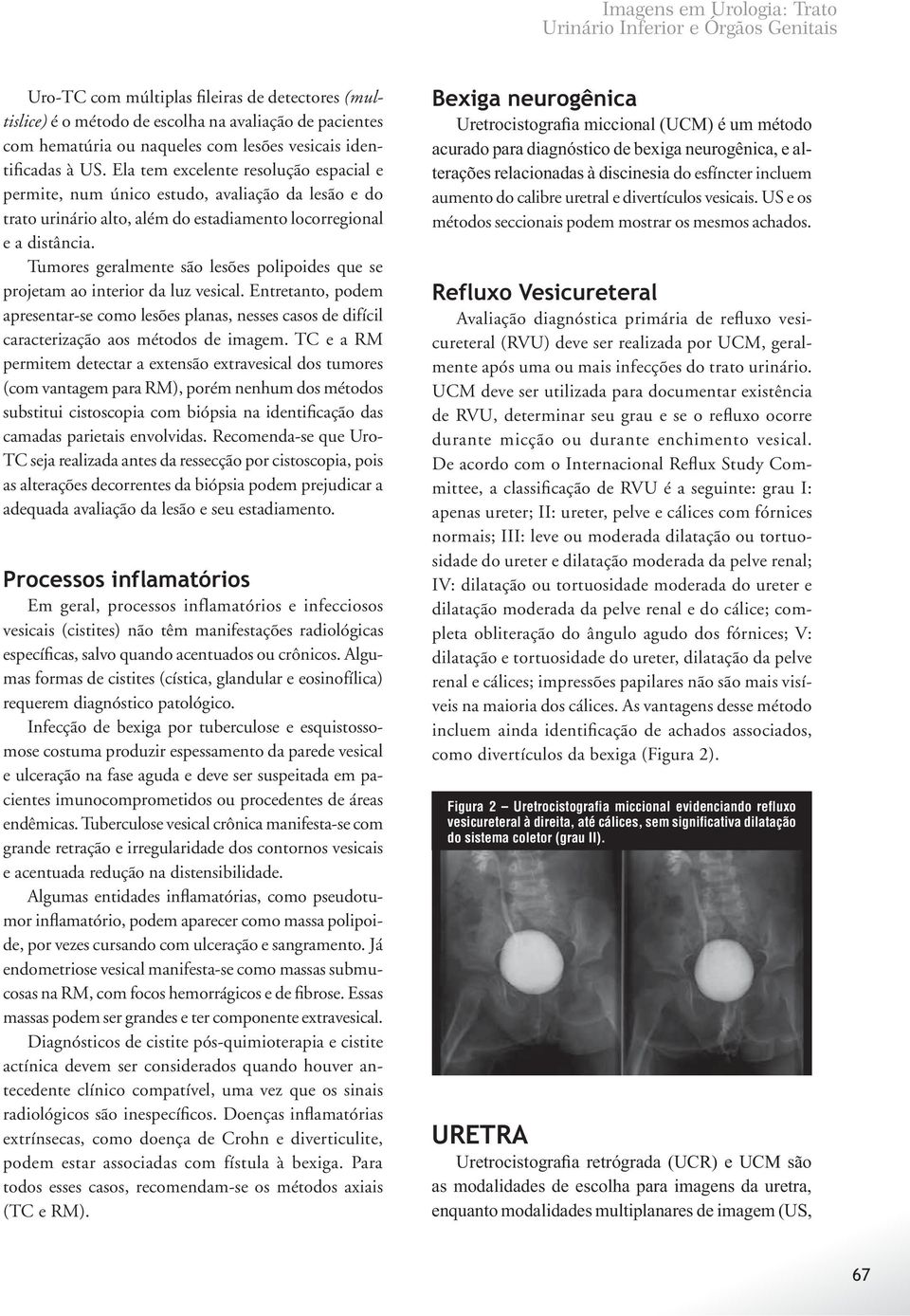 Tumores geralmente são lesões polipoides que se projetam ao interior da luz vesical. Entretanto, podem apresentar-se como lesões planas, nesses casos de difícil caracterização aos métodos de imagem.