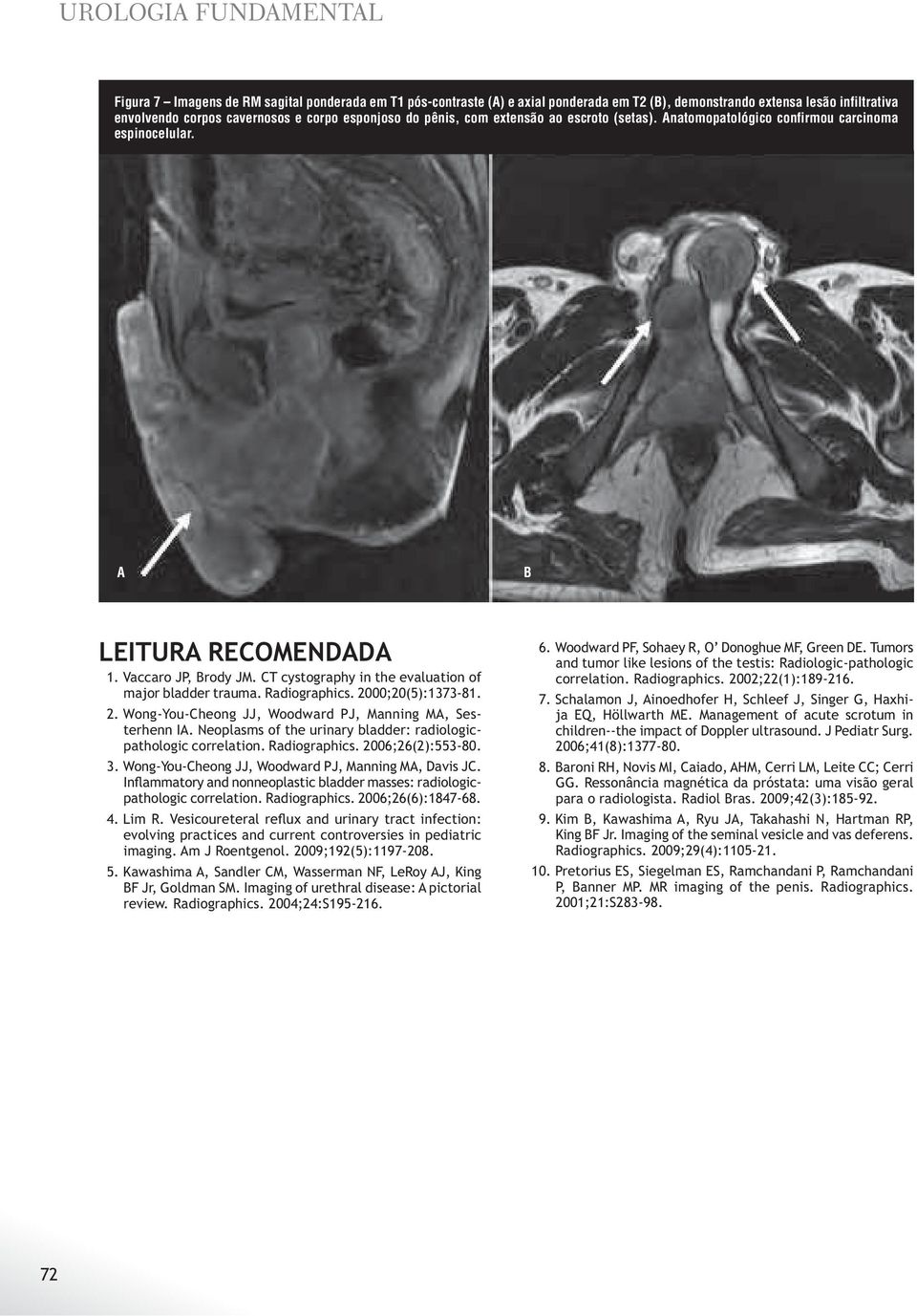 CT cystography in the evaluation of major bladder trauma. Radiographics. 2000;20(5):1373-81. 2. Wong-You-Cheong JJ, Woodward PJ, Manning MA, Sesterhenn IA.