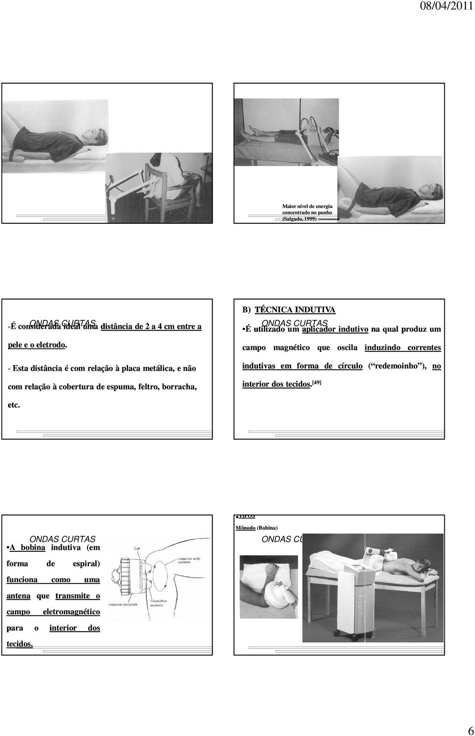 aplicador indutivo na qual produz um campo magnético que oscila induzindo correntes indutivas em forma círculo ( remoinho ), no interior dos